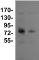 DnaK2 | Heat shock protein 70-2 (HSP70-2)